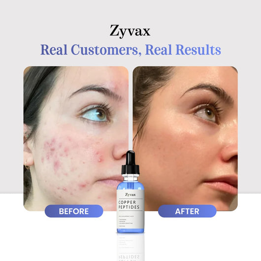 Zyvax GHK-CU