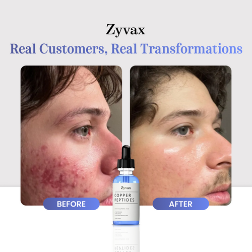 Zyvax GHK-CU